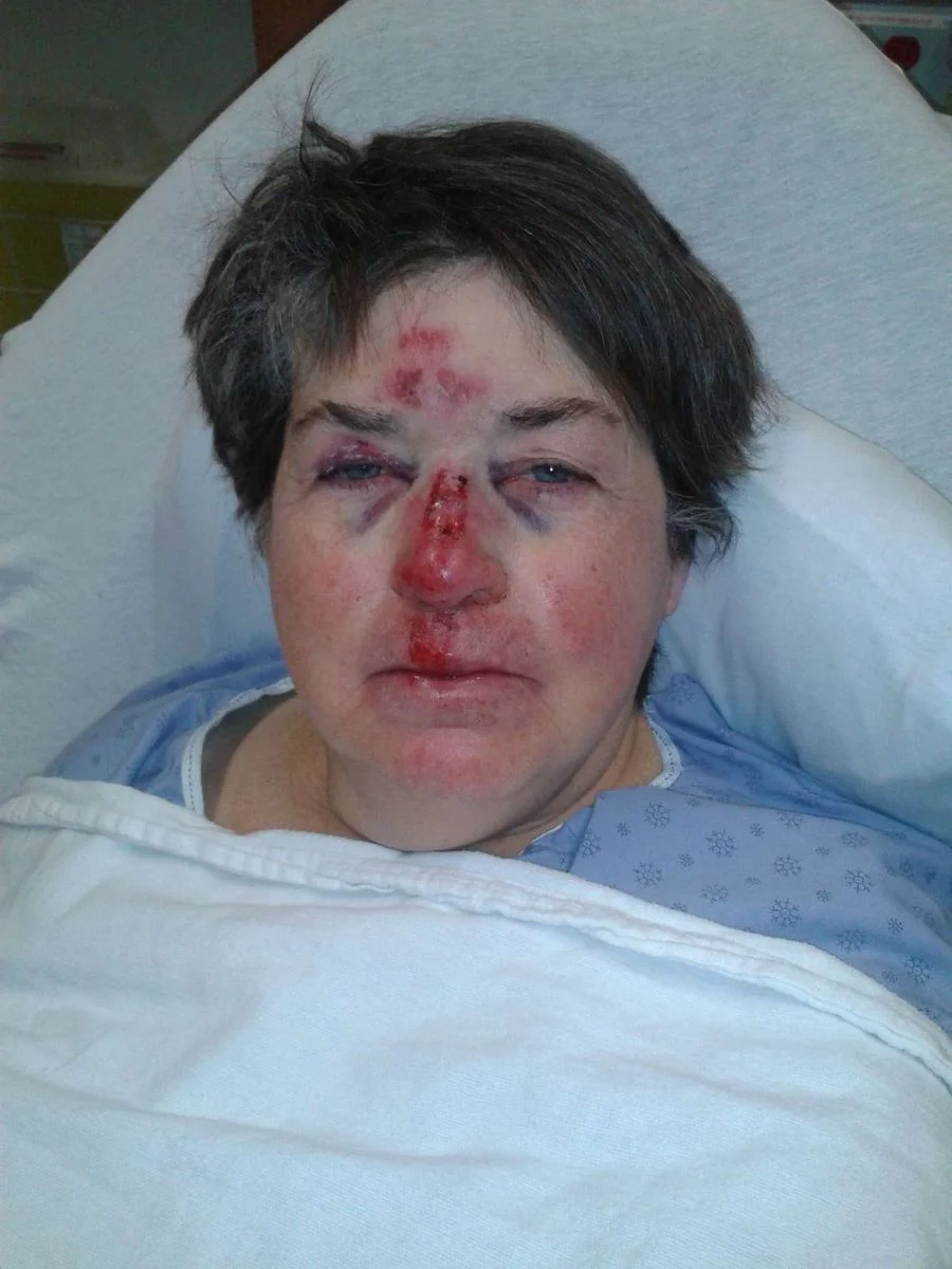 Accident 06 nov 2012.webp