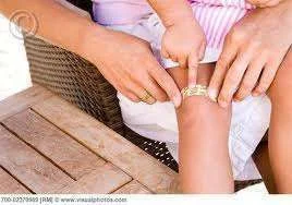bandaid on knee.webp