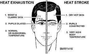 Heat stroke aimage.webp