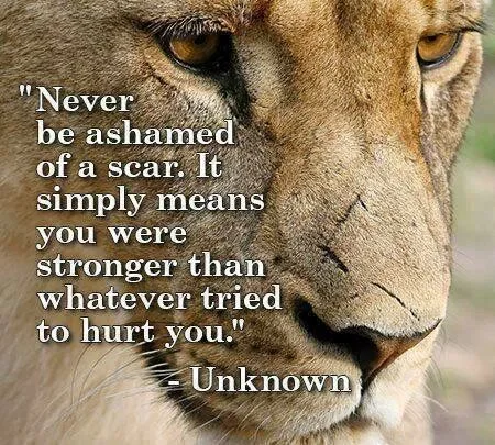 Scar.webp