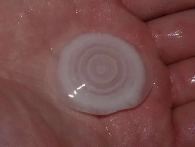 hailstoneclose.webp hailstoneclose.webp
