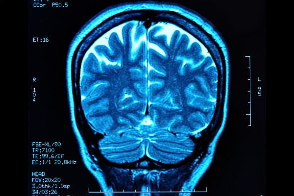 shutterstock_Brain.jpg