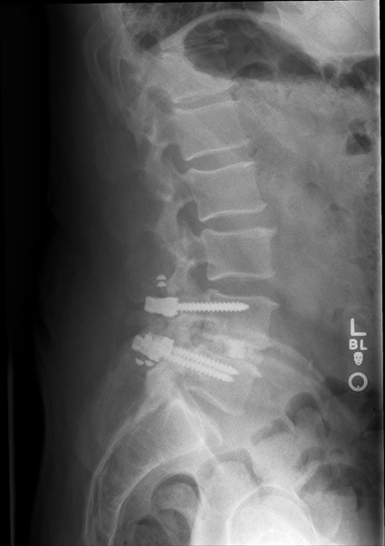 MyScrews.jpg